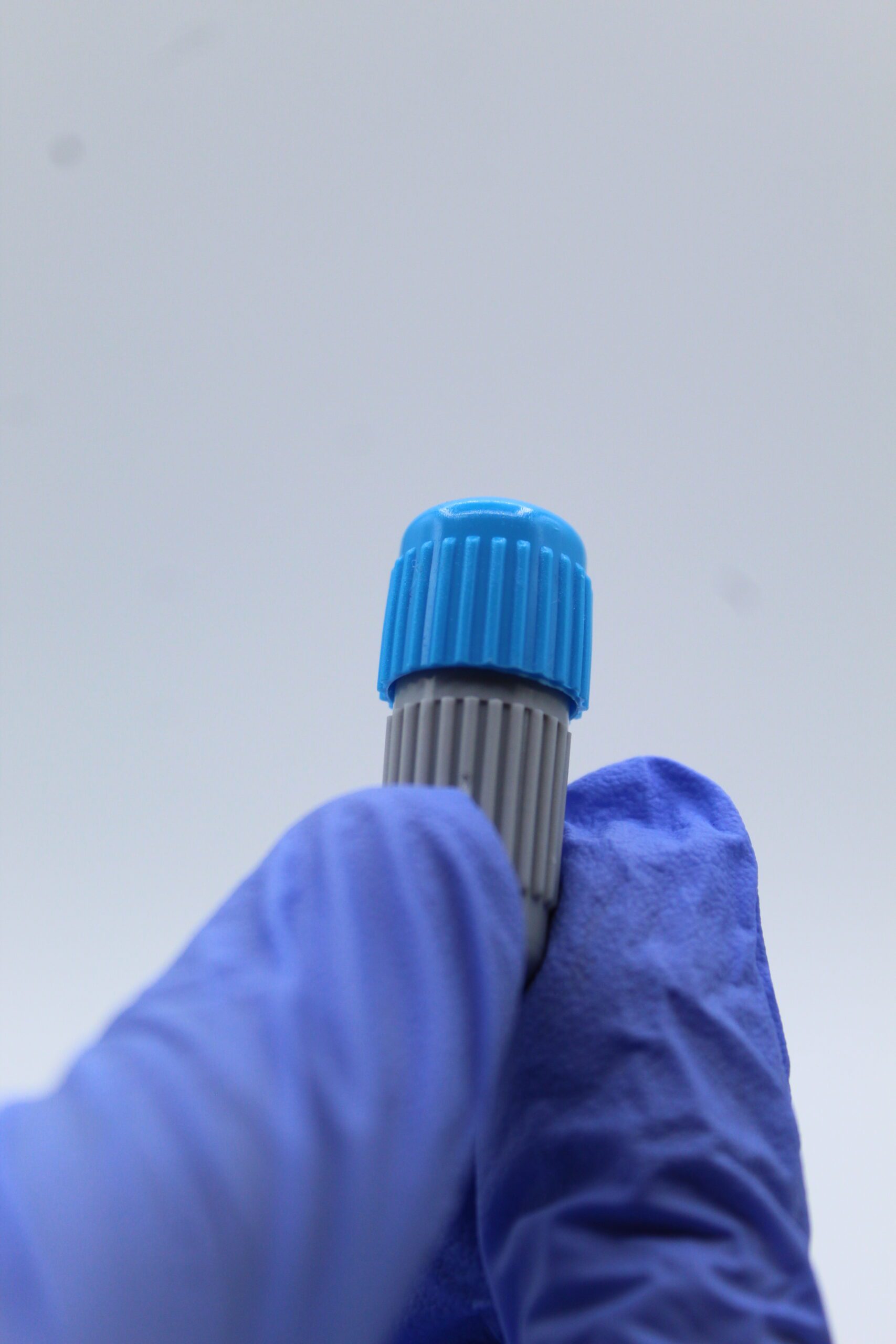 Dental Amalgam - Image 4